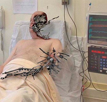 A man in a hospital bed, his flesh being replaced by metai